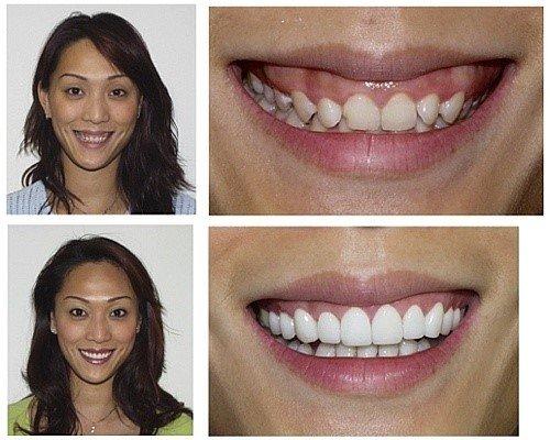 Melvin Elson, MD, FAAD