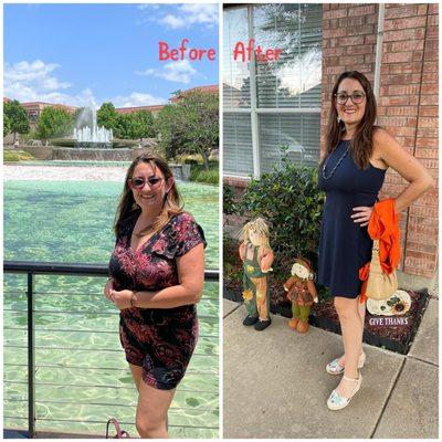 Interested in learning how our patient transformed, schedule now.