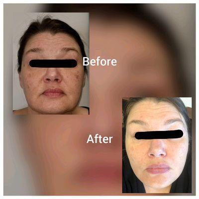 Pure Image Laser & Spa