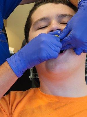 Making retainer molds!