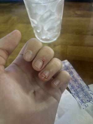 Snickers Bar & Grill