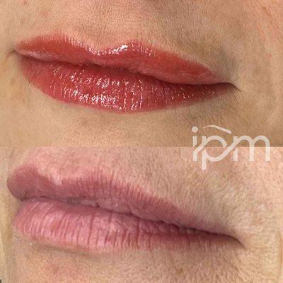 Before & After permanent Lip Blush/Contouring