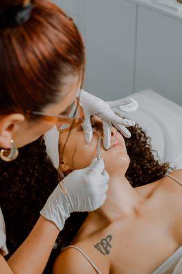 DERMAPLANING | Perfect for those looking to improve skins texture, fine lines, remove vellus hair (peach fuzz), and leave with glowy skin.