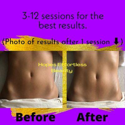 Hopes Effortless Beauty