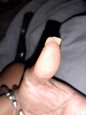 They chopped off my nails