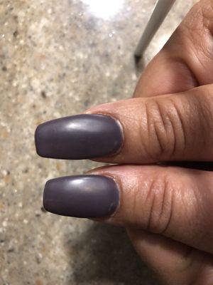Thumb nails are two different sizes. One clearly longer than the other.