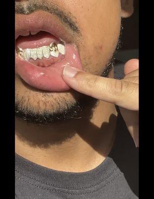 8 PIECE BOTTOM DIAMOND DUST WITH EXTENDED FANGS. 14k ROSE GOLD PLATED DRIP. CUSTOM PIECE