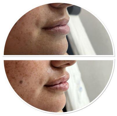 In love with my lips!