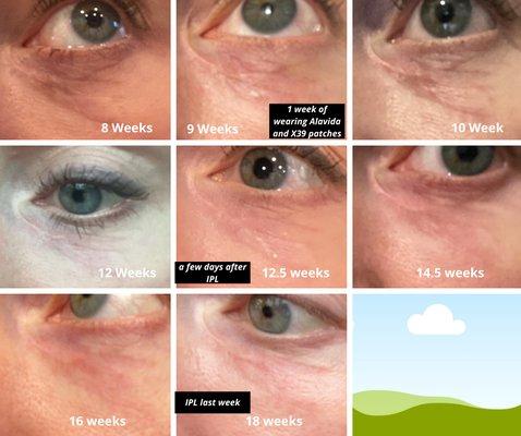 Brian Willoughby, MD