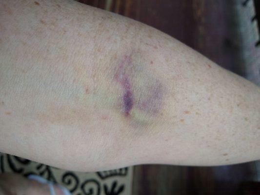 Big South Fork Medical