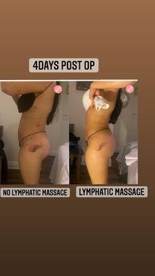 Hot Stone Massage and Body Sculpting