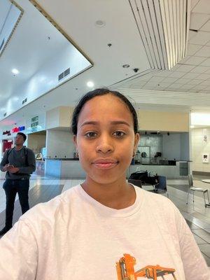 It's red due to the swelling but they look so much better!