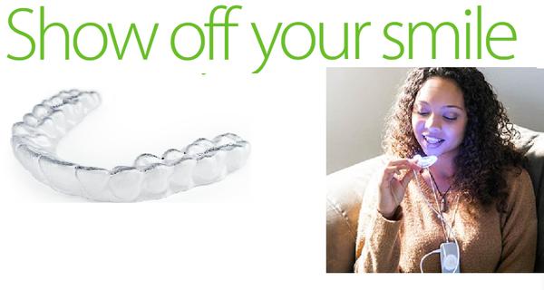 Way to straight and white teeth.