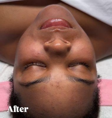 Clean, radiant, and refreshed -- your skin at its best