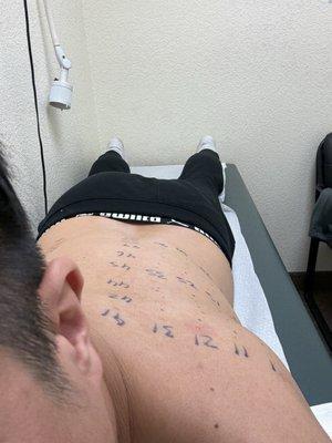 Allergy test