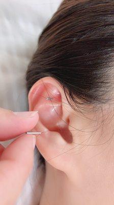 Lake Creek Acupuncture & Wellness