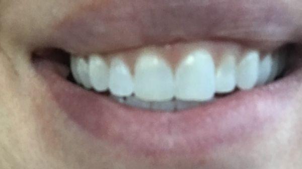 Image Dental