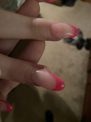 Where my skin is peeling