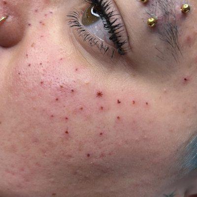 up close of the freckles from sara and two of the four eyebrow piercings done by ciara