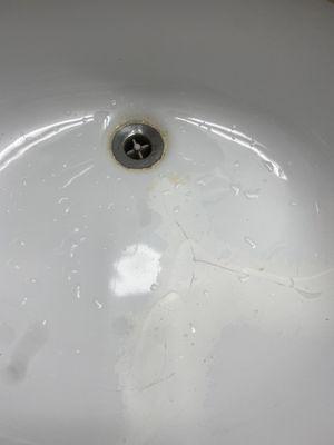 Cracked porcelain sink and poor attempt to patch
