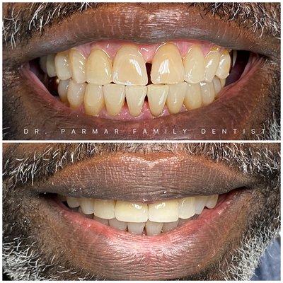 Cosmetic Dentistry by Dr. Shah