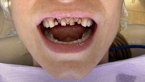 Valley Center Smiles