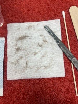 Dermaplane results! Book your facial today!