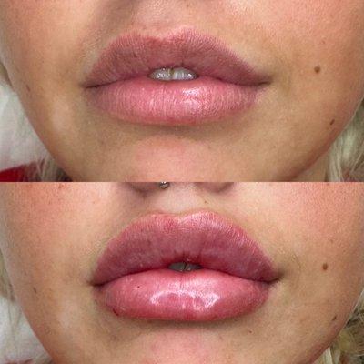 Michael Gray and Skindeep Spa