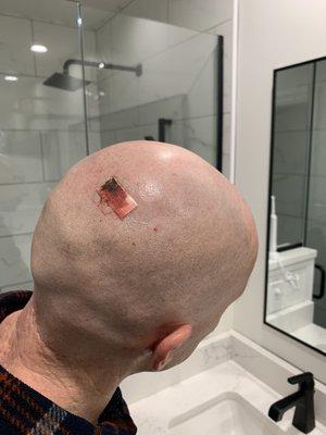 Cut to the back of the head.