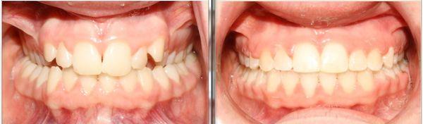 Upland Dental Implant & Orthodontics