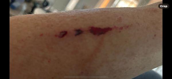 Injury of workers arm due to wooden skids placed in an unsafe manner in the produce department. Management abusive behaviors lead to injury.