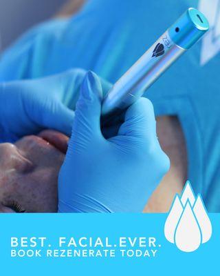 The Rezenerate Facial
