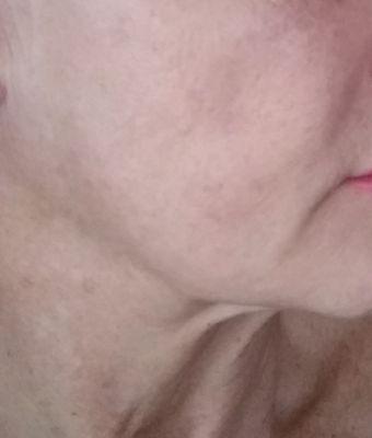 Carp Cosmetic Surgery Center