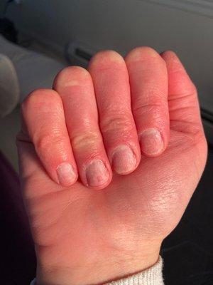 After wasting money and time my nails look like this.