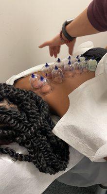 My sister getting cupping down.