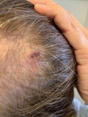 Head Injury from laundry doors