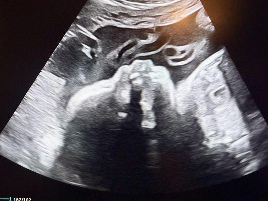 I Saw You First Imaging