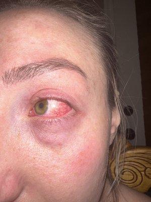 The outcome of my massage.