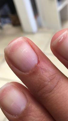 Was clipping dry cuticles during a gel mani and went too deep. My finger was leaking blood for about 4 minutes