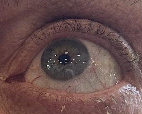 Let the eyes have it