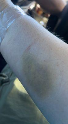 The Advanced Wound Center