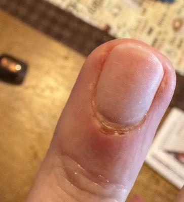 Cut cuticle that bled a lot and brush used to remove blood wasn't sanitized!!!!!!!!!