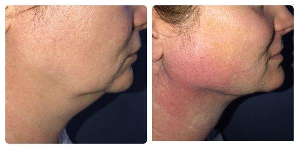 Thomas W. Barnes, MD