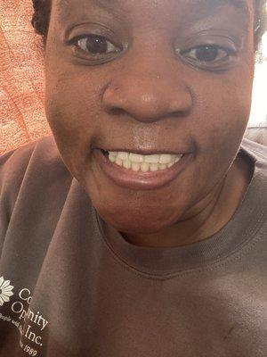 Clean teeth dentures