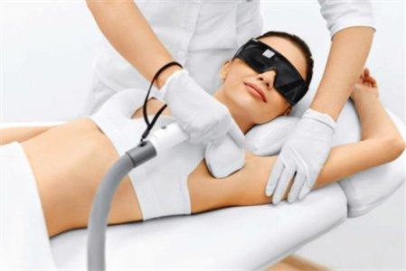 Laser hair removal
