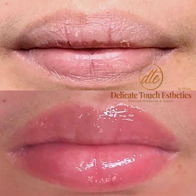 #Healed #LipsBlushing