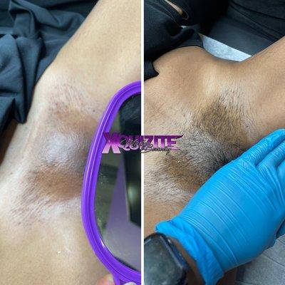 Brazilian Waxing benefits include: reduced ingrown hairs, hyperpigmentation and last 4-6 weeks!