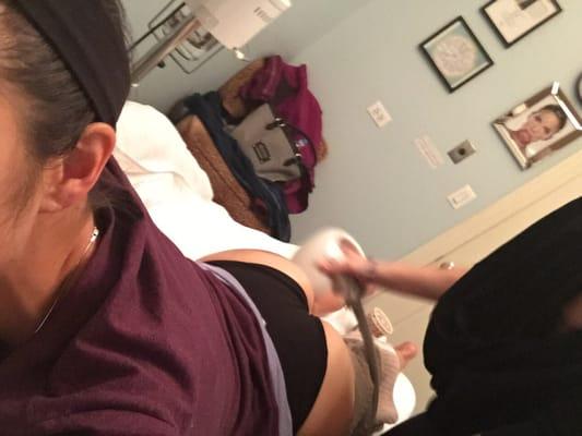 Cellulite removal with the accent machine!