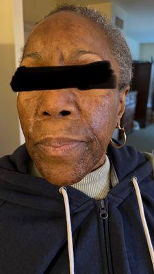 Sunrise at Fleetwood