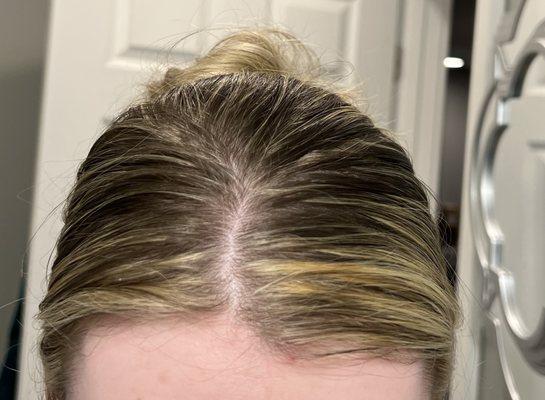 Here's a picture of the brassy and choppy highlights. I paid $300 for a full highlight, and the stylist sent me home with this wreck.